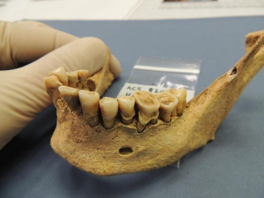 ancient teeth